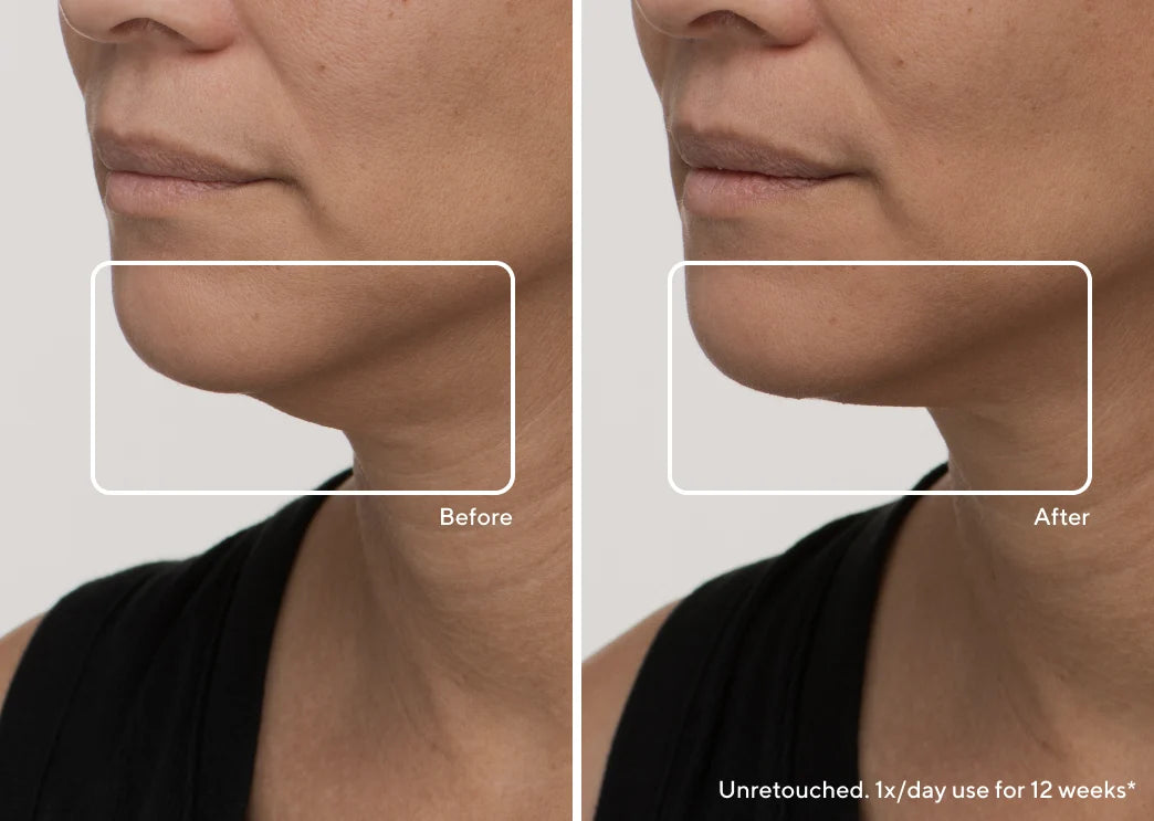 TheraFace Mask by Therabody: LED Light Therapy & Vibration for Radiant Skin