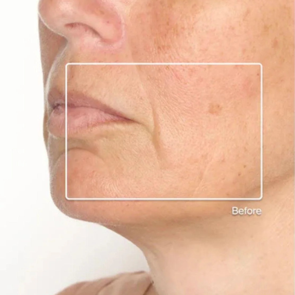 Rivete Advanced Recovery & Mobility 