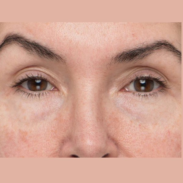 TheraFace PRO Facial Therapy Bundle: Mood Edition + Optional Hot/Cold Rings
