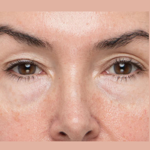 TheraFace PRO Facial Therapy Bundle: Mood Edition + Optional Hot/Cold Rings