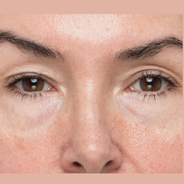 TheraFace PRO Facial Therapy Bundle: Mood Edition + Optional Hot/Cold Rings