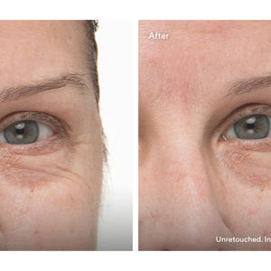 Therabody Beauty Sleep Bundle