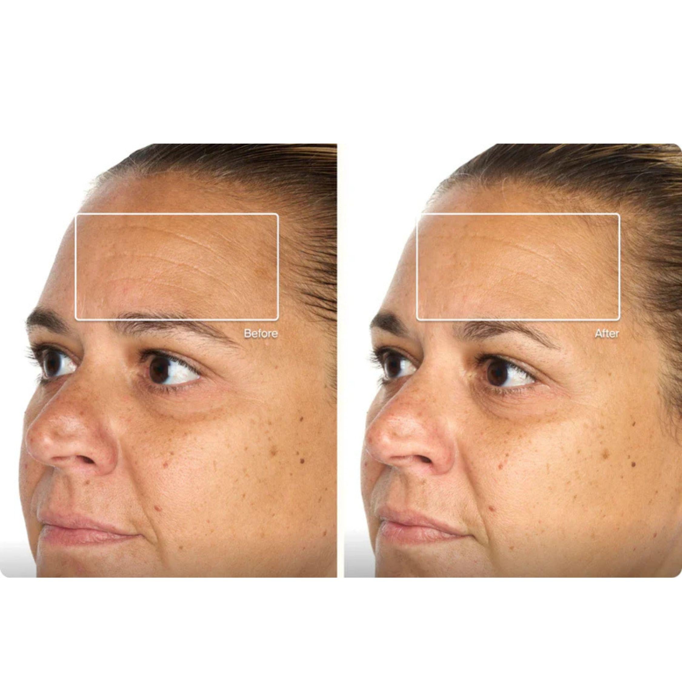Theraface Mask Glo