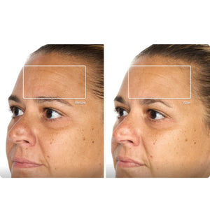 Theraface Mask Glo