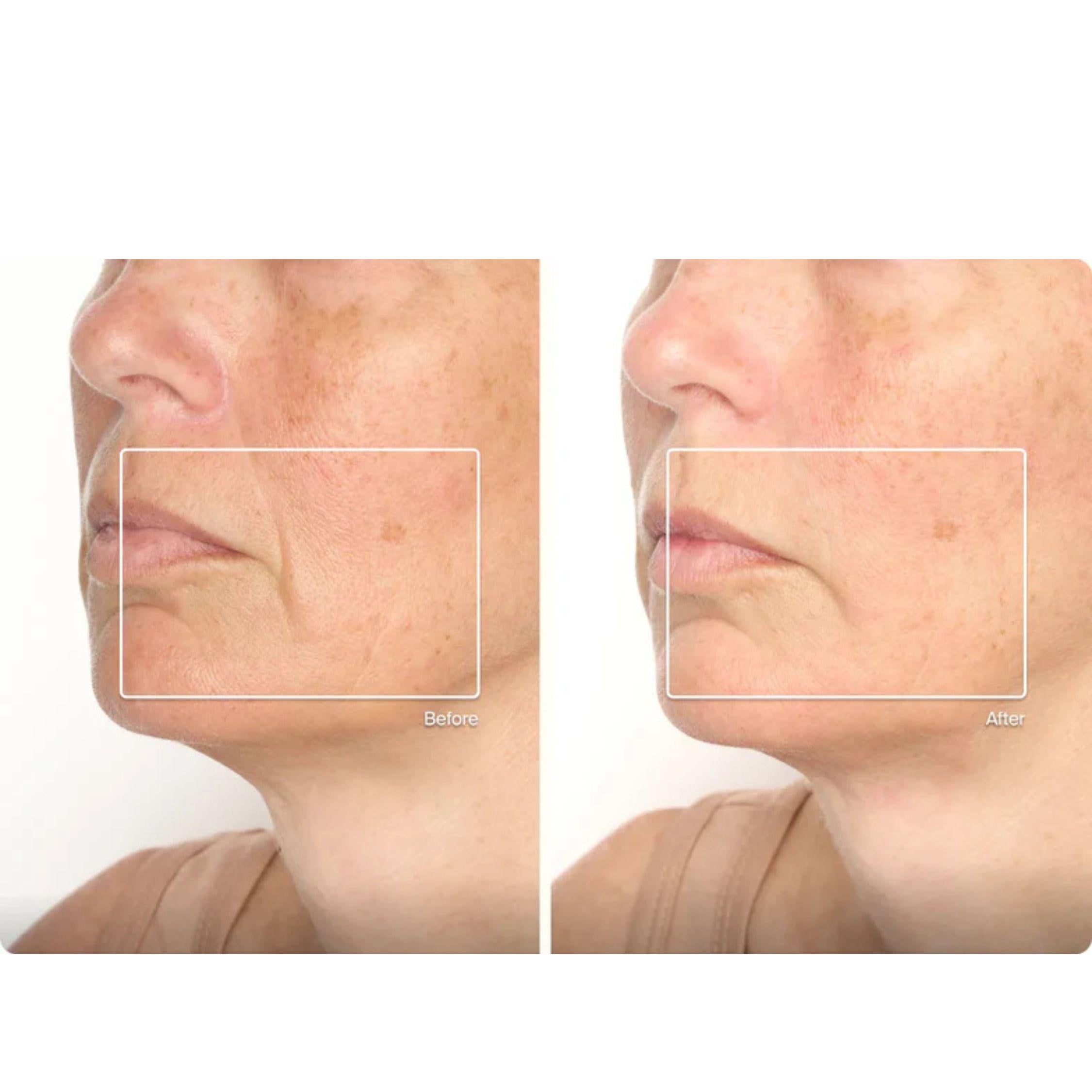 Theraface Mask Glo