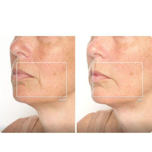 Theraface Mask Glo